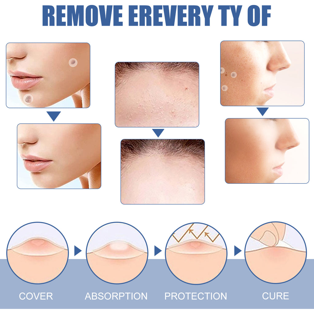 EELHOE Gram Wart Corns Patch, Skin Gram Wart Flesh Mole Black Mole Clean And Care Patch