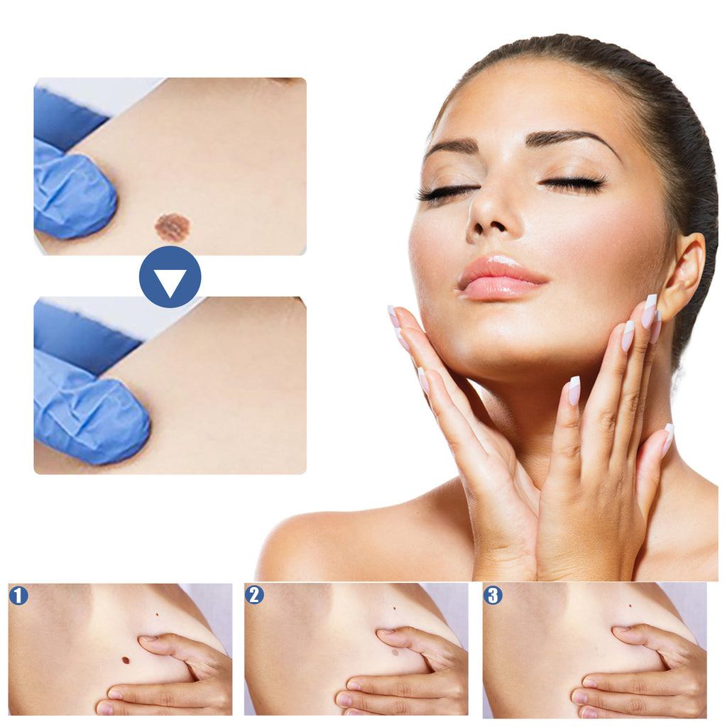 EELHOE Gram Wart Corns Patch, Skin Gram Wart Flesh Mole Black Mole Clean And Care Patch